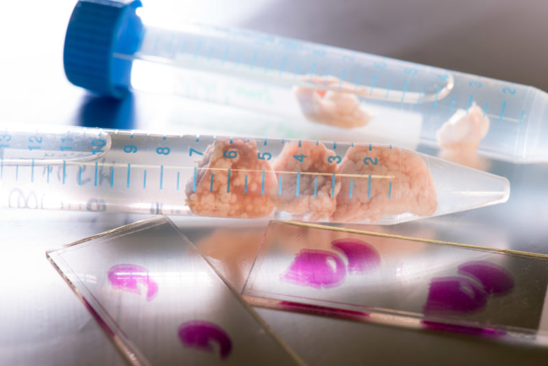 Wissenschaftsfotografie: Nahaufnahme von Proben mit tierischer Gehirnmasse in durchsichtigen flüssigkeitsgefüllten Glasröhrchen und feinen Gewebeschnitten, die für die mikroskopische Untersuchung auf Glasträgern aufgebracht sind und violett angefärbt wurden.