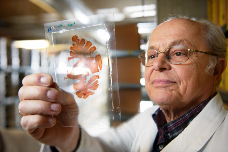 Wissenschaftsfotografie: Seniorprofessor für Anatomie Heiko Braak imit dem Forschungsschwerpunkt Klinische Neuroanatomie begutachtet einen dünnen Gewebeschnitt durch ein menschlichens Gehirn.