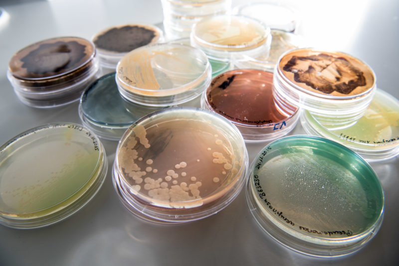 Science photography: Such multi-coloured cultures with microbes stored in incubators are the starting material for research into new antibiotics at the Interfaculty Institute of Microbiology and Infection Medicine Tübingen (IMIT) at the University of Tübingen.