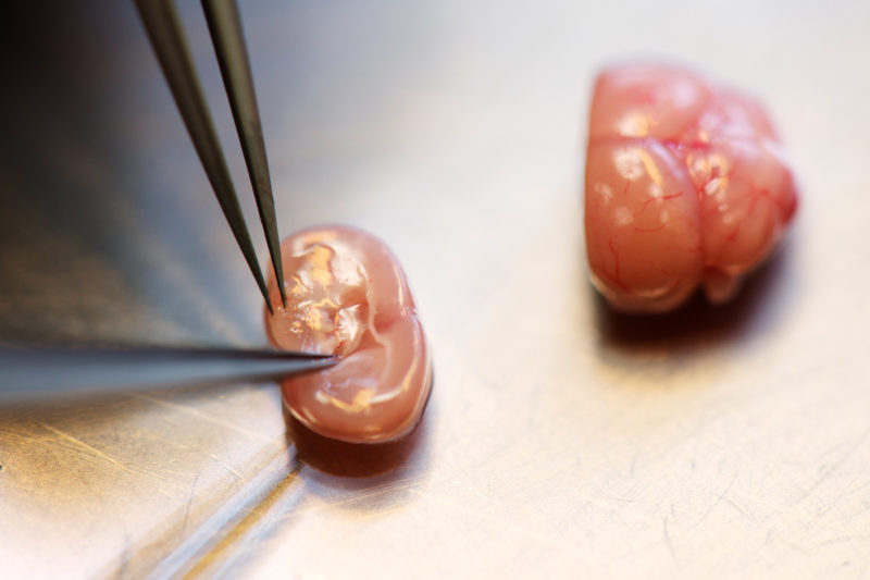 Science photography: Splitting of a mouse brain to get cell cultures for stem cell research.