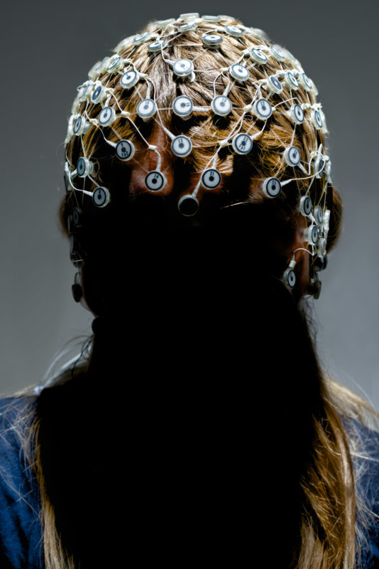 Studio photogaphy: A hood with electroencephalogram electrodes on a patient