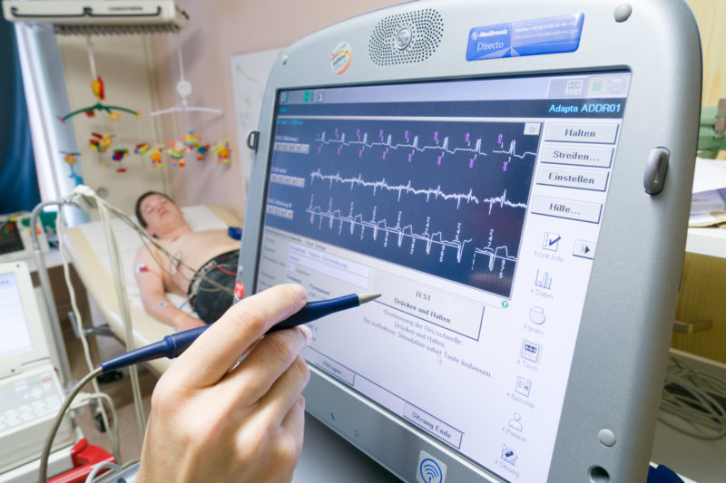 Medizinfotografie: In der Ambulanz der Kinderkardiologie der Universitätsklinik Homburg (Saar) wird ein EKG geschrieben, um den Herzschrittmacher eines Heranwachsenden zu überprüfen und zu justieren. Im Hintergrund sieht man den jungen Patienten mit den auf dem Brustkorb angeschlossenen EKG-Kabeln.