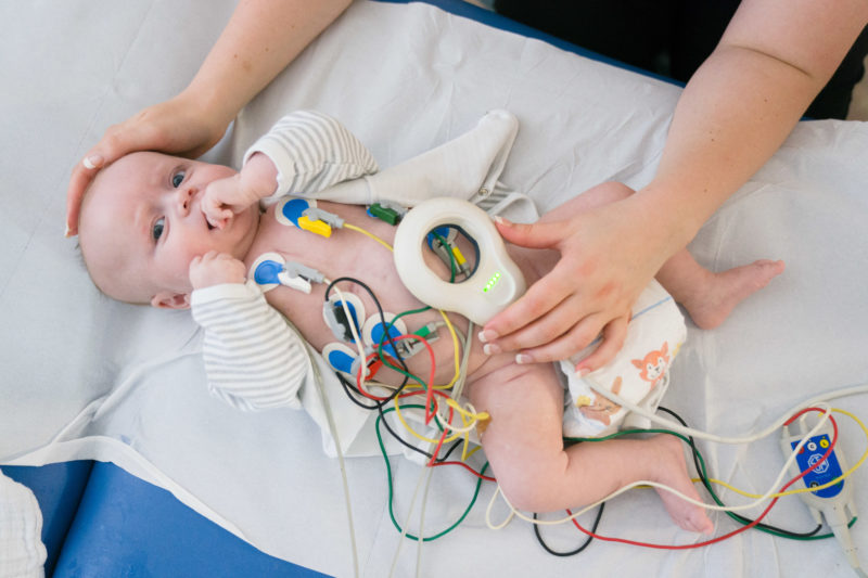 Healthcare photography: In the paediatric cardiology department of the Homburg University Hospital (Saar), the implanted pacemaker of a baby is checked and readjusted with the help of a sensor.