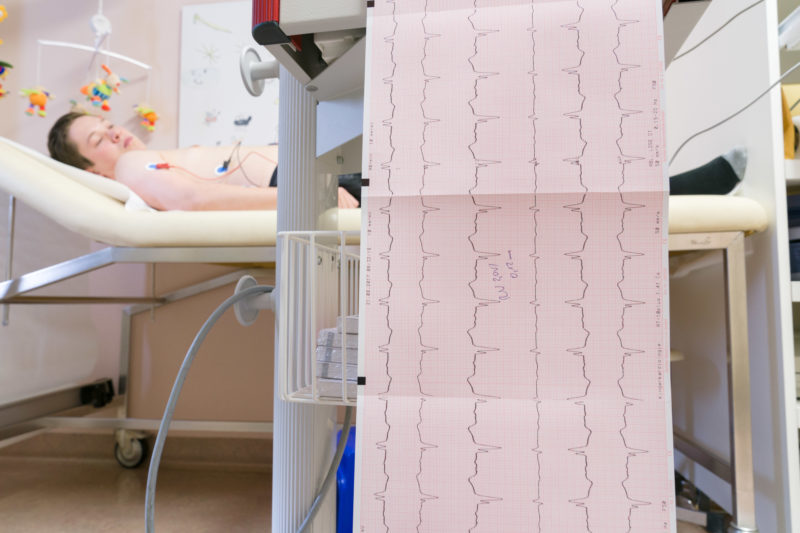 Medizinfotografie: in der Kinderkardiologie der Universitätsklinik Homburg (Saar) wird bei einem jungen Patient ein Elektrokardiogramm geschrieben.