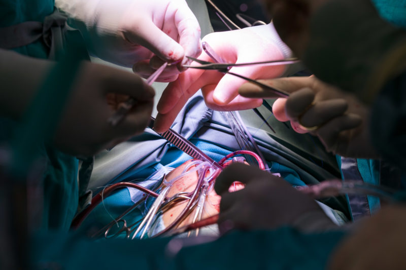 Healthcare photography:  In the paediatric cardiology department of the University Hospital Homburg (Saar). Open heart surgery.